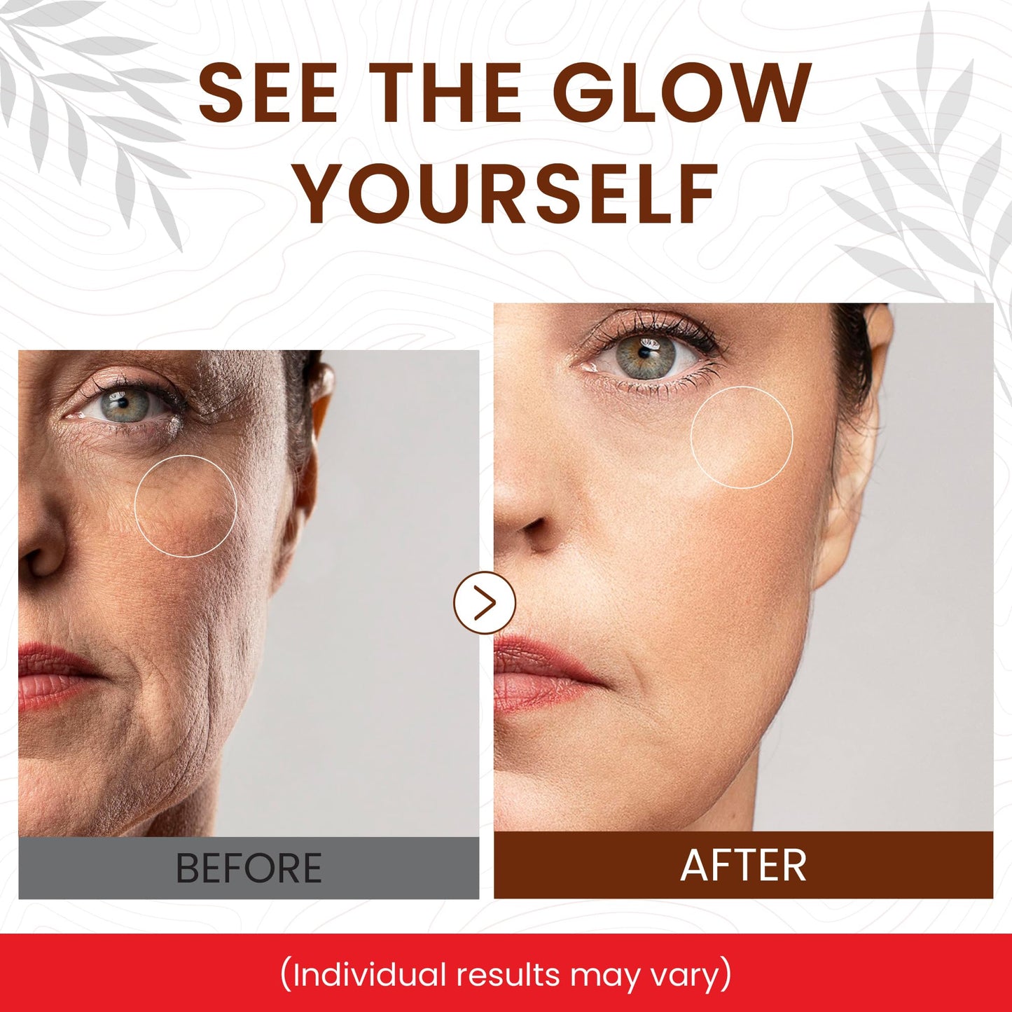 Rapid Dark Spot Remover for Face & Body – Glow Boosting Serum | Vitamin C and Hyaluronic Acid | Age & Sun Spot Corrector, Brown Spot Remover | Anti-Aging | Super Hydrating | Firming & Lifting