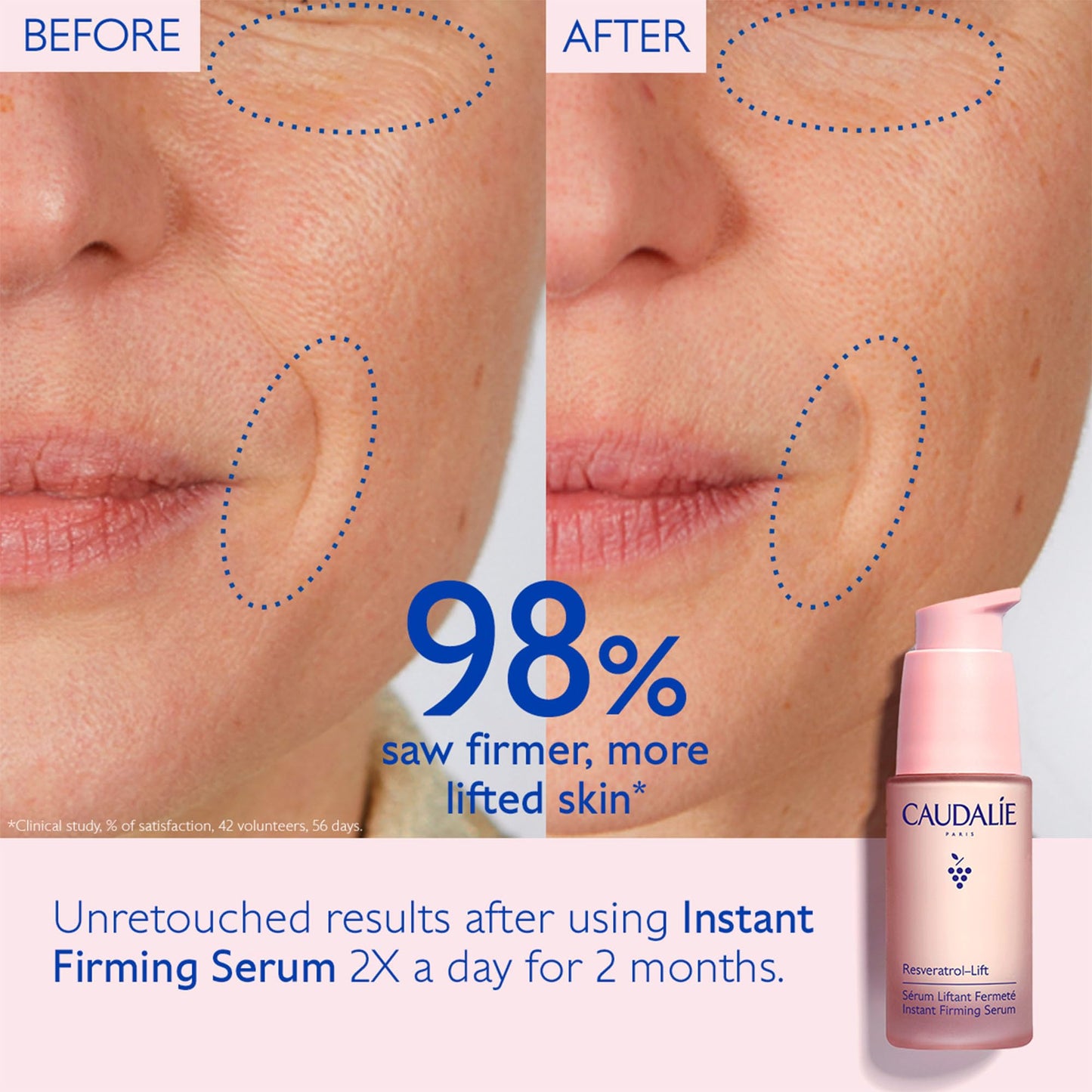 Caudalie Resveratrol-Lift Instant Firming Retinol Alternative Serum - 30 mL
