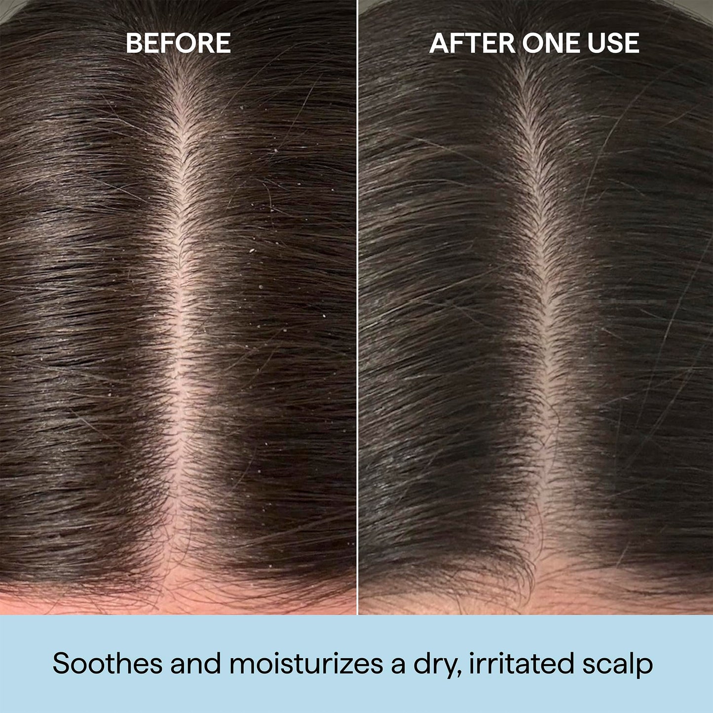 Briogeo Scalp Revival Rosemary Pre-Wash Oil | Moisturizing Scalp Treatment for Dry, Flaky, or Itchy Scalp | Strengthens Hair & Soothes Scalp | Vegan & Cruelty-Free | 1 oz