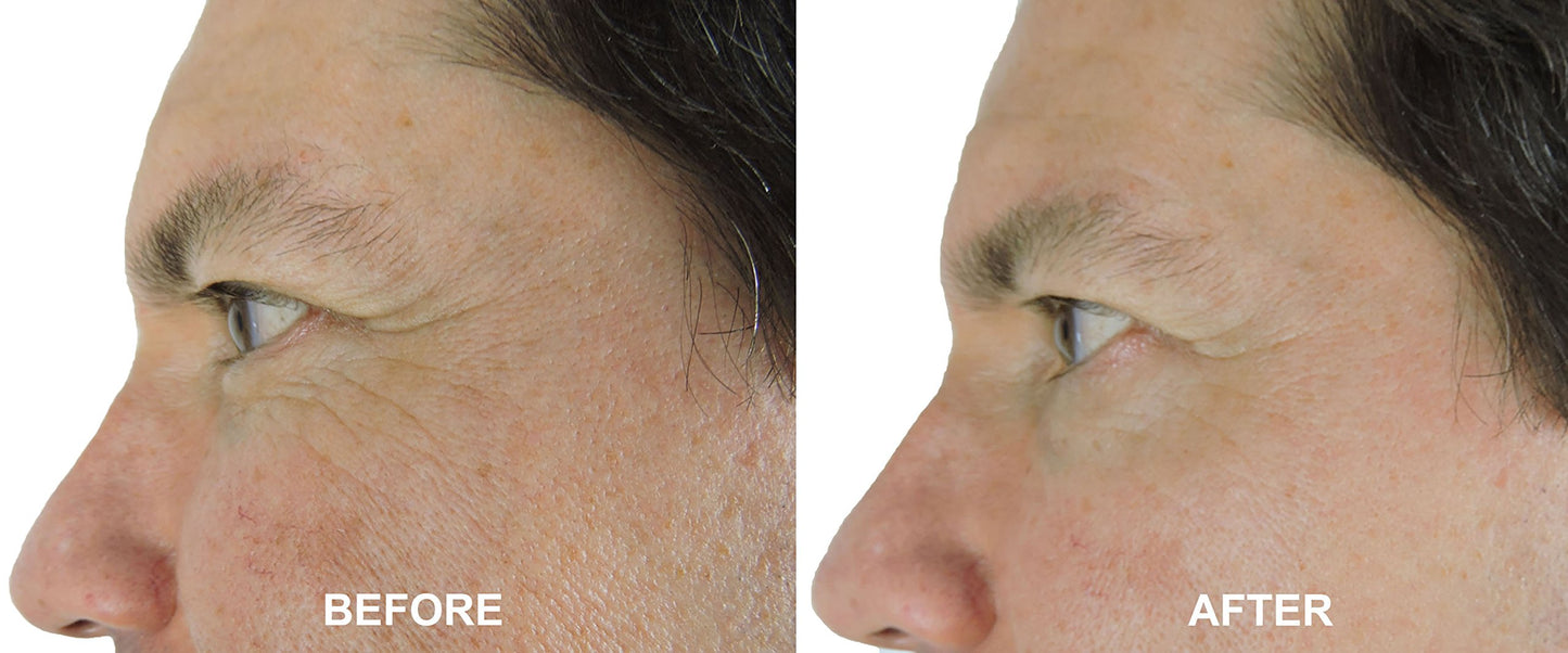 DNA Code®-No Needle Alternative-Argireline Copper Peptide Wrinkle Reduce Serum Booster w/Snap-8, Matrixyl 3000