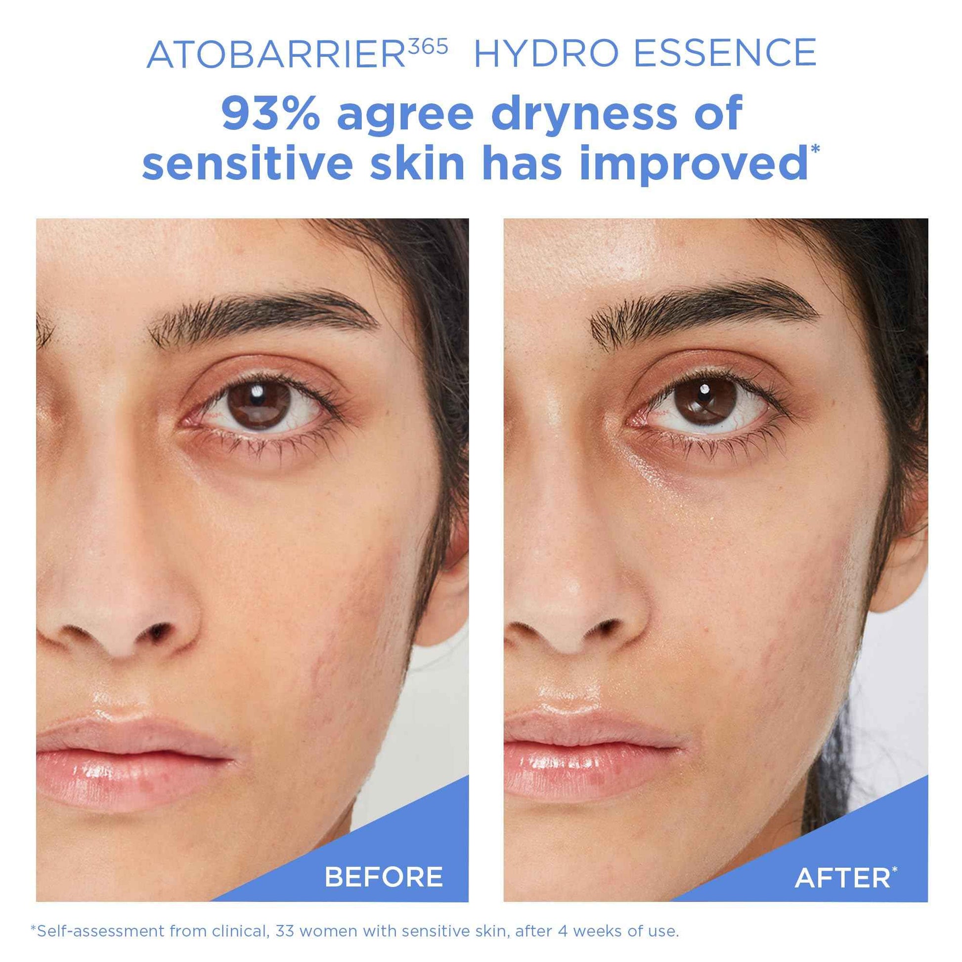 AESTURA ATOBARRIER365 Hydro Essence with Hydrating Amino Acids for Face | Lightweight Formula, Deep Hydration, Suitable for Dry & Sensitive Skin, Non-Comedogenic, 100ML / 3.38 fl. oz.