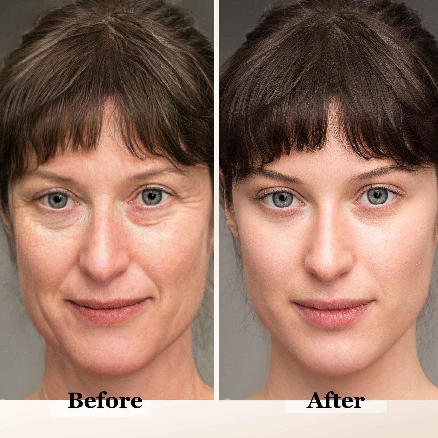 mivida Advanced Retinol Cream for Face & Neck | 6-in-1 Anti-Aging Moisturizer with Collagen, Hyaluronic, Vit C & E | Firms, Reduces Wrinkles, Fine Lines & Dark Spots | Daily Face Cream 1.7floz