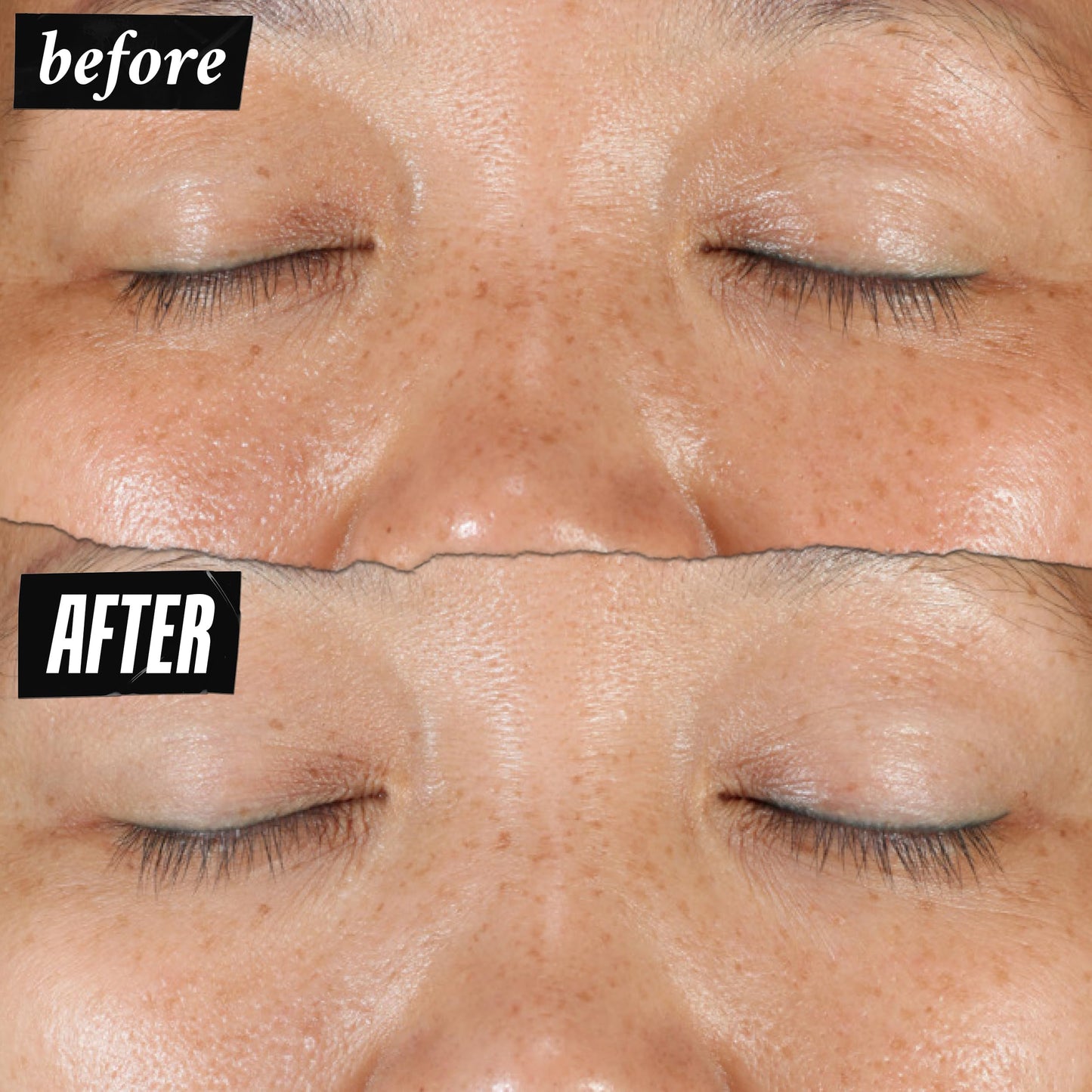 Kiehl's Clearly Corrective Dark Spot Serum, Corrective Skincare Solution Clinically Proven to Even Skin Tone, Plump Skin, Reduce Hyperpigmentation & Boost Radiance, Use as Spot Treatment or Serum