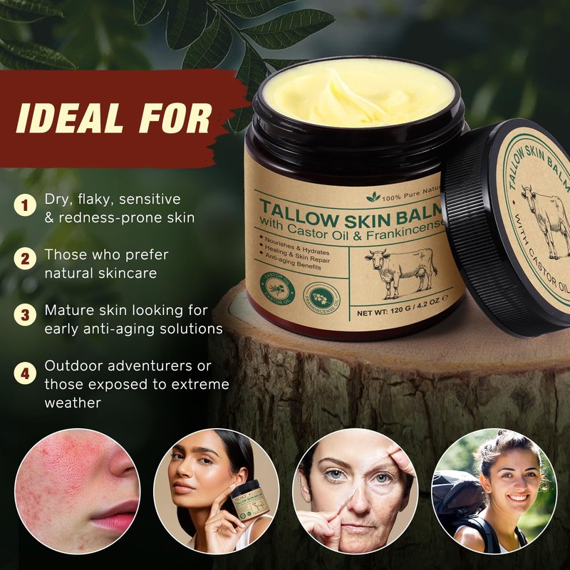 2 Pcak Beef Tallow Cream with Castor Oil and Frankincense, 100% Grass-Fed Tallow for Skin Care, Face & Body Moisturizer for Skin, Sensitive Skin & Dry Skin Age Defying, Eczema All-Purpose Balm