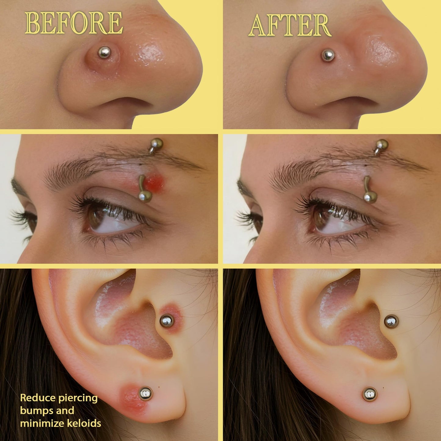 BodyJ4You Keloid Bump Removal Oil - Piercing Aftercare Shrinking Drops - Nose Ear Septum Belly Cartilage Scar Treatment Piercing Bump Solution - Tea Tree Jojoba Essential Oils Keloid Care (Pack of 4)