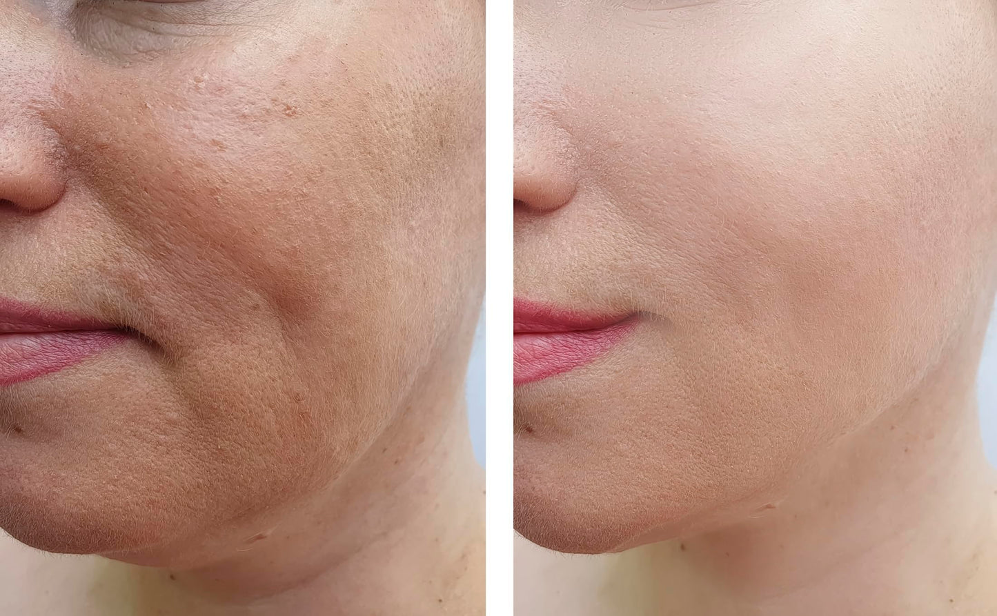 Vitality Precision Skin Retinol Peel Pads .5%- 3 month supply