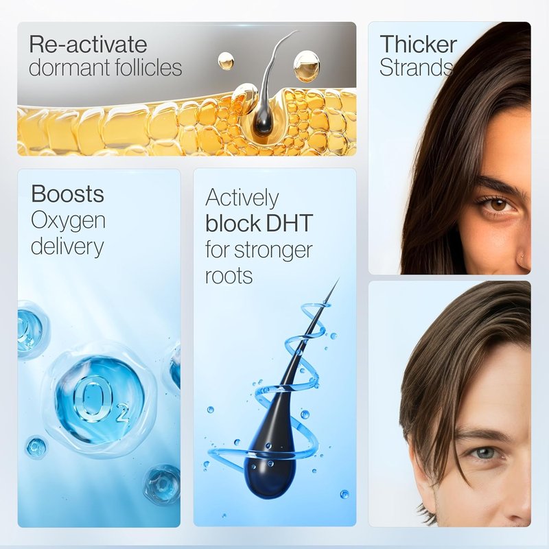 Rosemary Hair Growth Serum Roll-On - DHT-Blocking Scalp Treatment | 50 ml with 3% Rosemary, 3% Redensyl, 2% Anagain | Paraben/Sulfate-Free for Men & Women