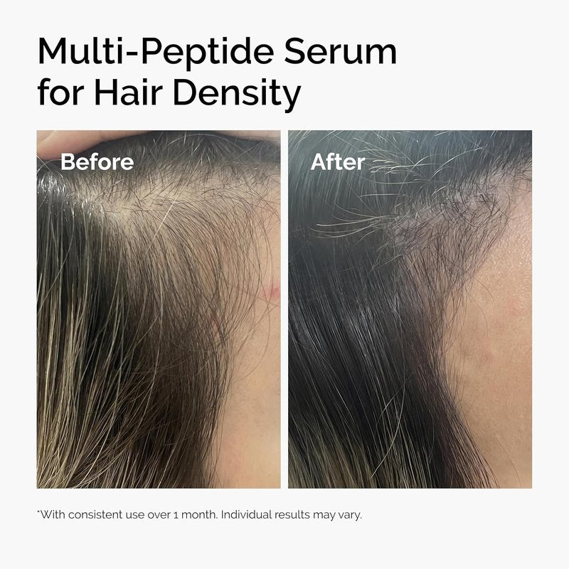 Multi-Peptide Hair Density Serum - Thicker, Fuller Hair Formula | 1 Fl Oz
