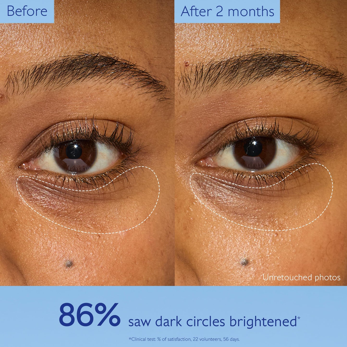 Caudalie Vinoperfect Dark Circle Brightening Caffeine Eye Cream with Niacinamide, Fragrance Free - 15 mL