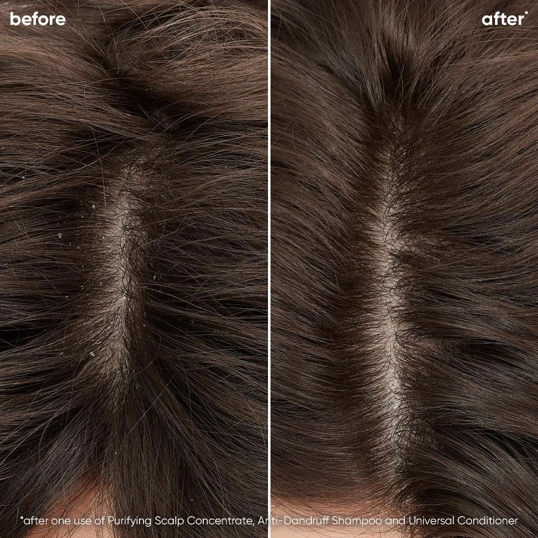 Biolage Scalp Sync Universal Conditioner | Lightweight Conditioner | Nourishes Hair & Promotes Healthy Scalp | Fermented Tea & Glycolic Acid | Sulfate-Free | Paraben-Free | For All Scalp Types