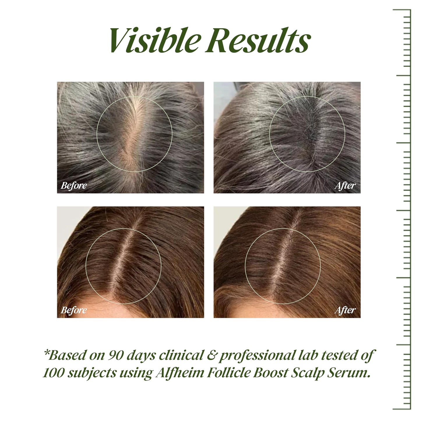 ALFHEIM Saw Palmetto Follicle Boost Scalp Serum Travel Size, Clinically Tested Formula for Thinning Hair, Peptides, Caffeine & Biotin, 0.34 fl Oz