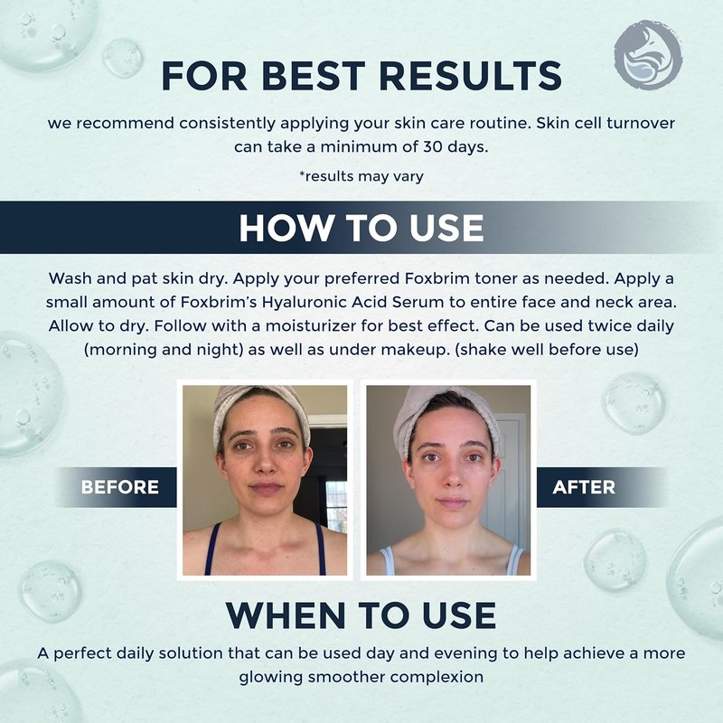 Hyaluronic Acid Face Serum - Hydrating Anti-Aging Formula with Vitamin C, E & Jojoba Oil | 1 Oz
