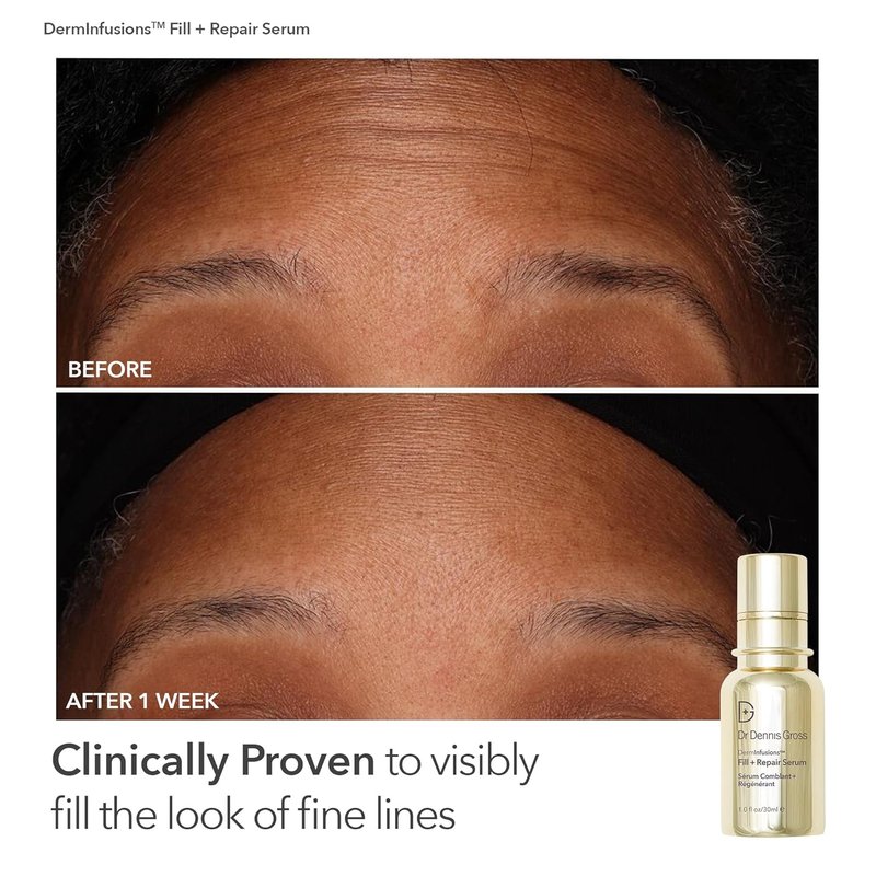 Dr. Dennis Gross Fill, Plump & Firm Kit - Hyaluronic Acid Serum, Eye Cream & Lip Treatment | Boost Hydration & Smooth Fine Lines