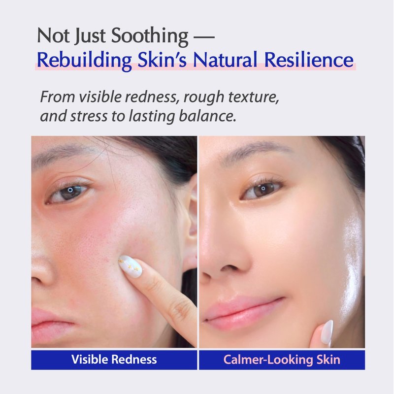 liv.reome MSM Sulfur-Derived Redness Recovery Cream for Sensitive, Thin Skin – Probiotic Exosome + Panthenol + Ceramide NP