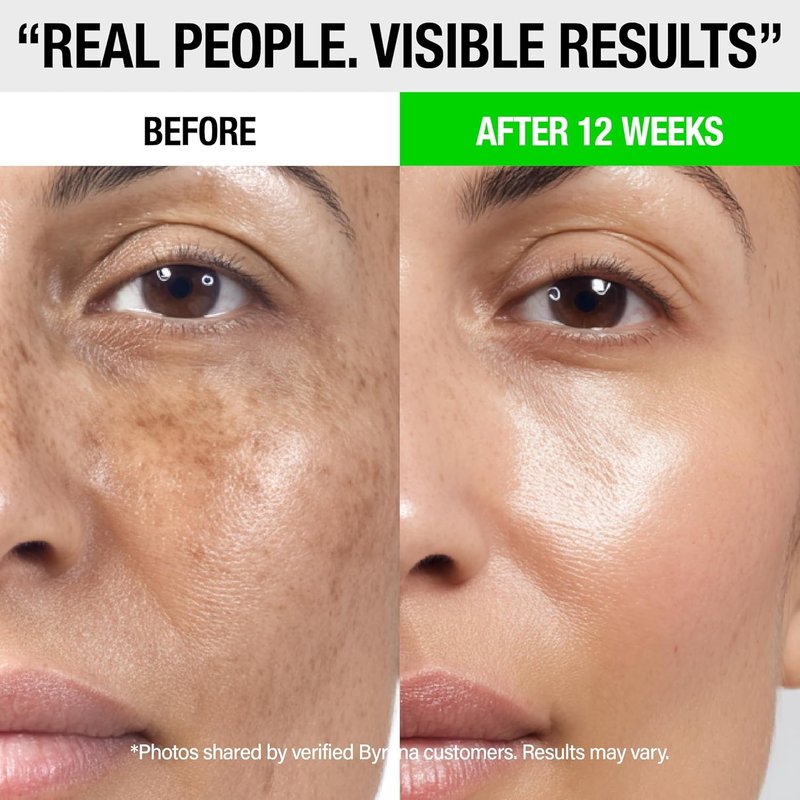 Dark Spot Clarity Oil Serum - Vitamin C for Uneven Tone & Post-Acne Marks | Korean Vegan Skincare with Ginseng, Licorice & Arbutin - 1 oz