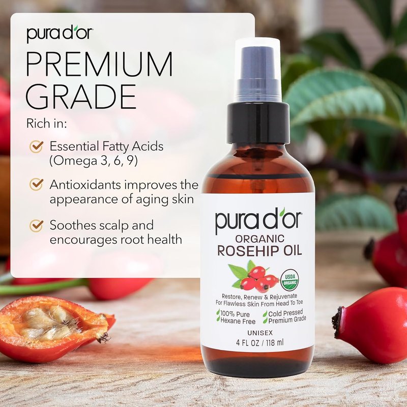 Organic Rosehip Seed Oil Hair Relaxer - 100% Pure Cold Pressed | Anti-Aging & Scar Treatment, 12 Oz
