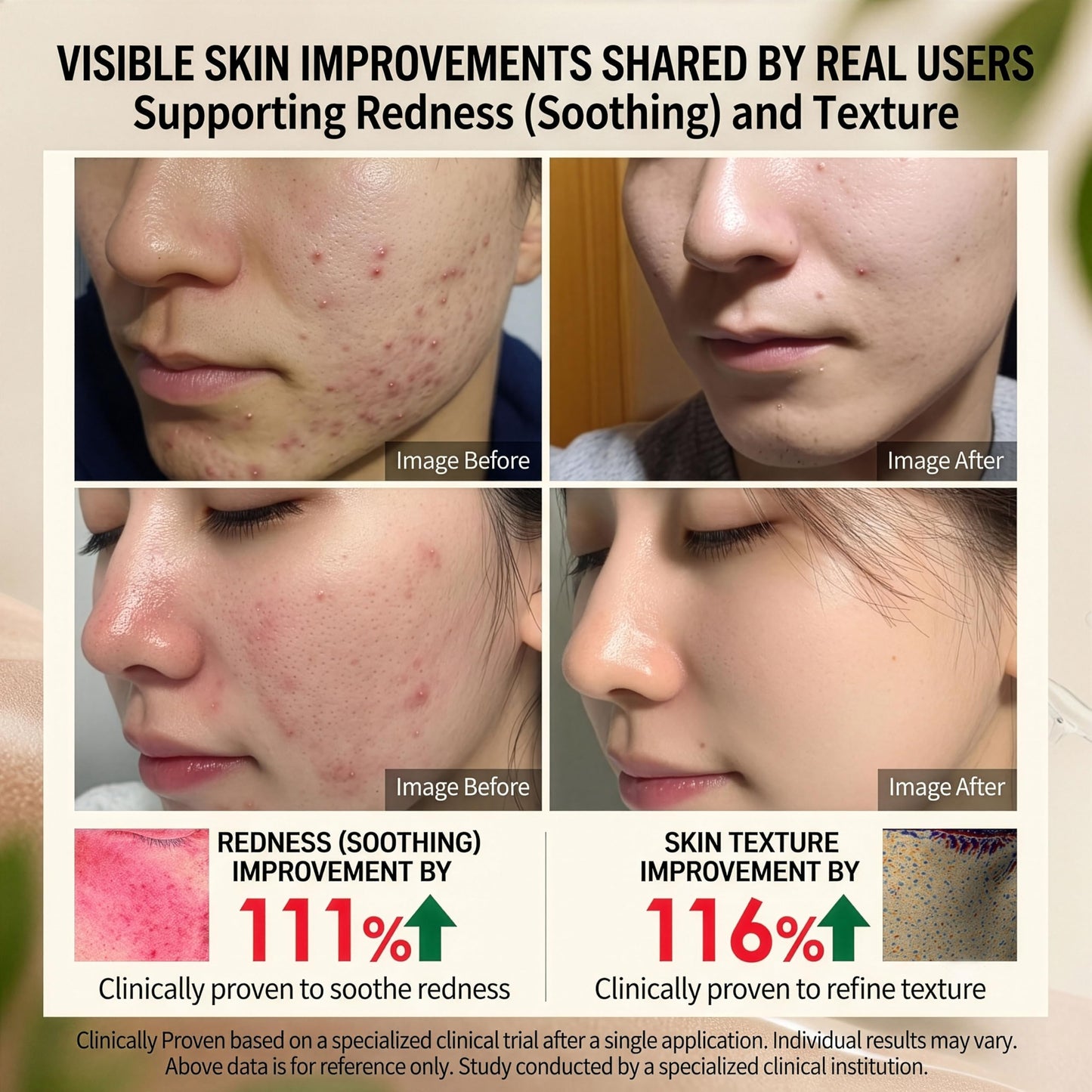 Korean Centella Asiatica Serum - Redness Corrector for Face - 38% Cica Leaf Water and Madecassoside - Ph Balanced - Barrier Support - Lightweight Calming - Rosacea Skincare - Centella Ampoule