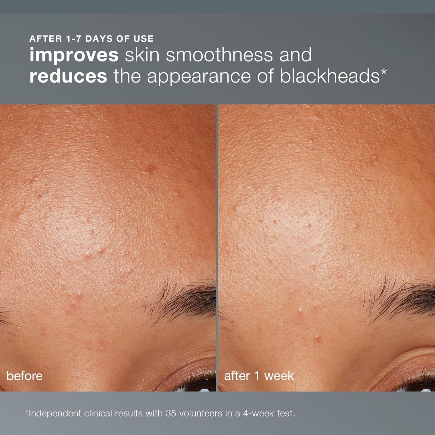 Dermalogica Daily Microfoliant - Face Exfoliator Powder with Salicylic Acid & Papaya Enzyme | Brighter, Smoother Skin