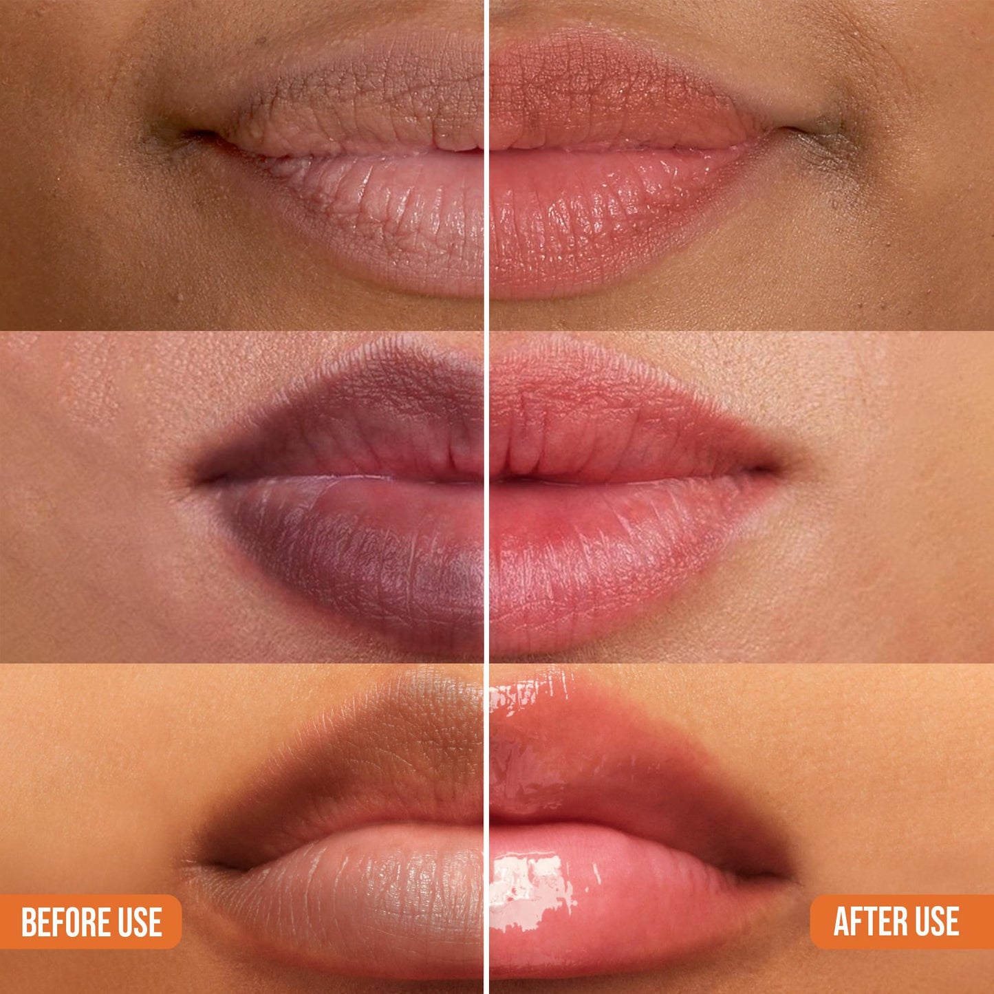 ABERA Dark Lips Corrector Cream, Lip Lightening For Dark Lips For Men & Women, Fordyce Spot Remover, Moisturizing Lip Plumper with Shea Butter