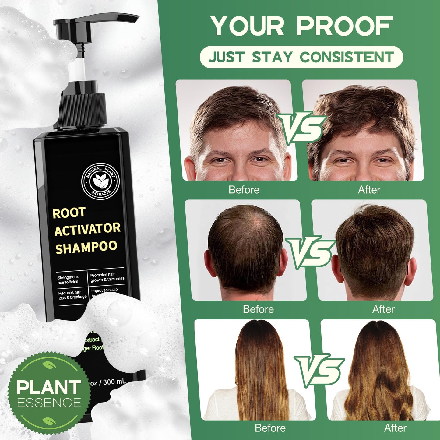 Root Activator Shampoo for Hair Growth - Natural Formula DHT Blocker with Fo-Ti Root and Ginger to Strengthen Follicles, Shampoo for Man & Women to Thinning and Lost Hair