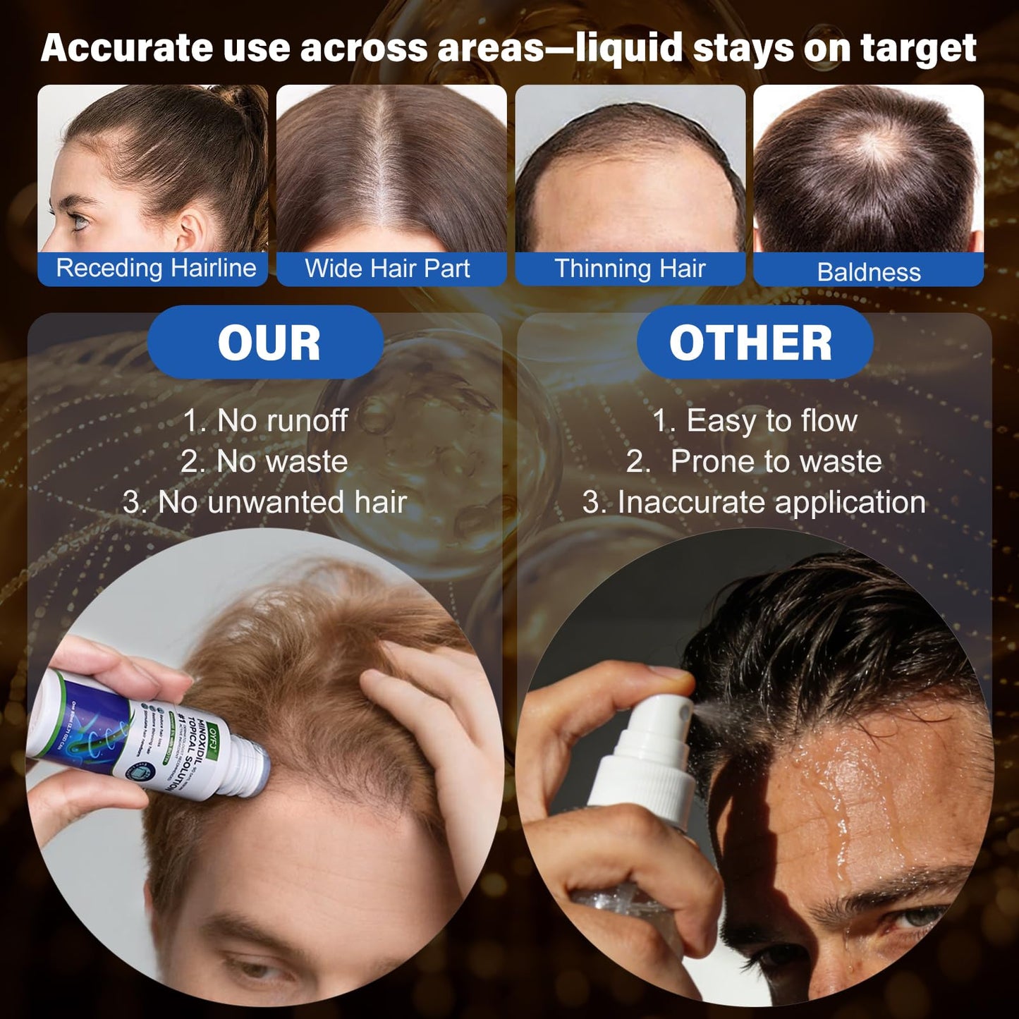6 Pack 5% Minoxidil for Men and Women,Minoxidil Beard and Hair Growth Serum(Biotin-Infused) with Sponge Applicator for Thinning Hair and Sparse Beards,8-Month Supply 6 x 2.7 FL OZ