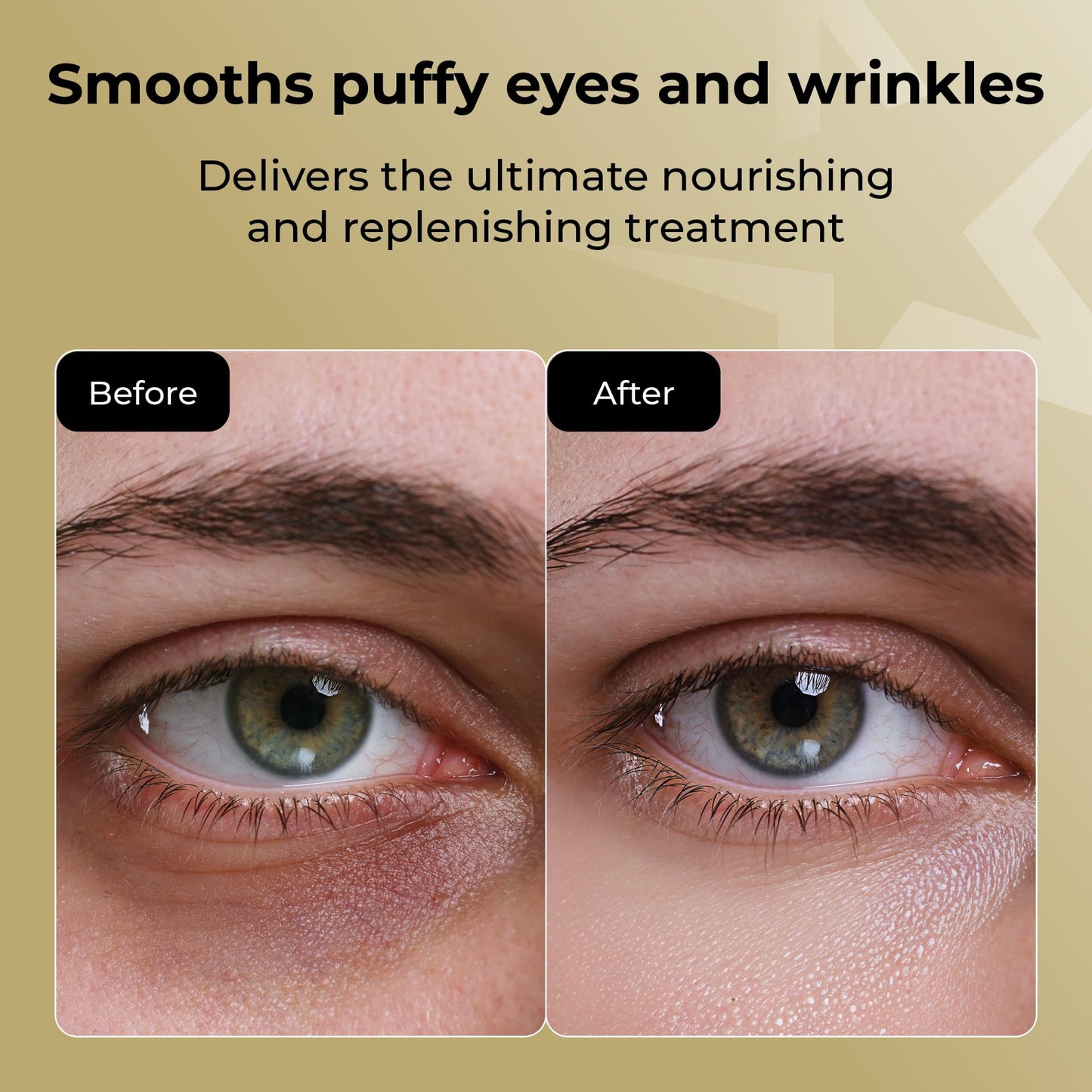 STARSKIN The Gold Mask Eye - Luxury Gold Foil-Topped Cellulose Eye Mask - Serum Concentrated with 83% Rose of Jericho - Smooths Puffy Eyes and Wrinkles