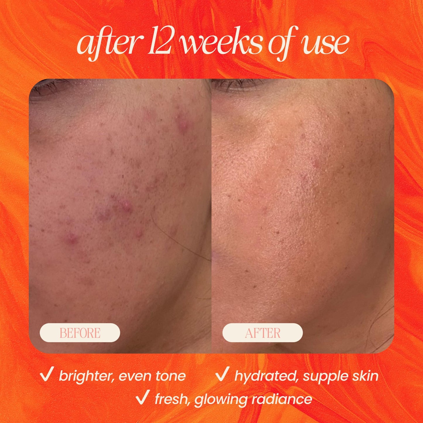 Milky Dark Spot Serum with 10% Stable Vitamin C & Ferulic Acid for Sensitive & Acne-Prone Skin | Collagen-Boosting Serum for Hyperpigmentation, Uneven Skin Tone | 1 fl oz | Mudita Earth