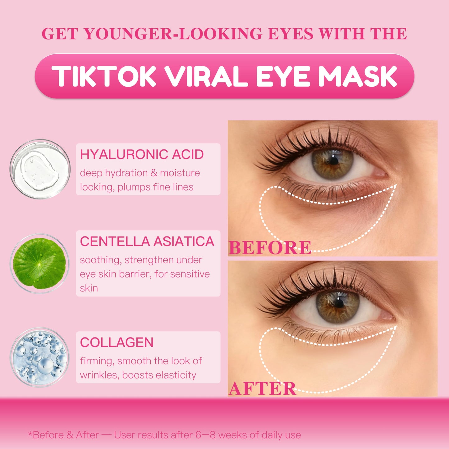 ICIKOL Under Eye Patches with Centella Collagen for Puffy Eyes and Dark Circles, Hydrogel Eye Patch with Hyaluronic Acid for Hydrating, Wrinkles, Women Travel Essentials & Self Skin Care Gifts 60PCS