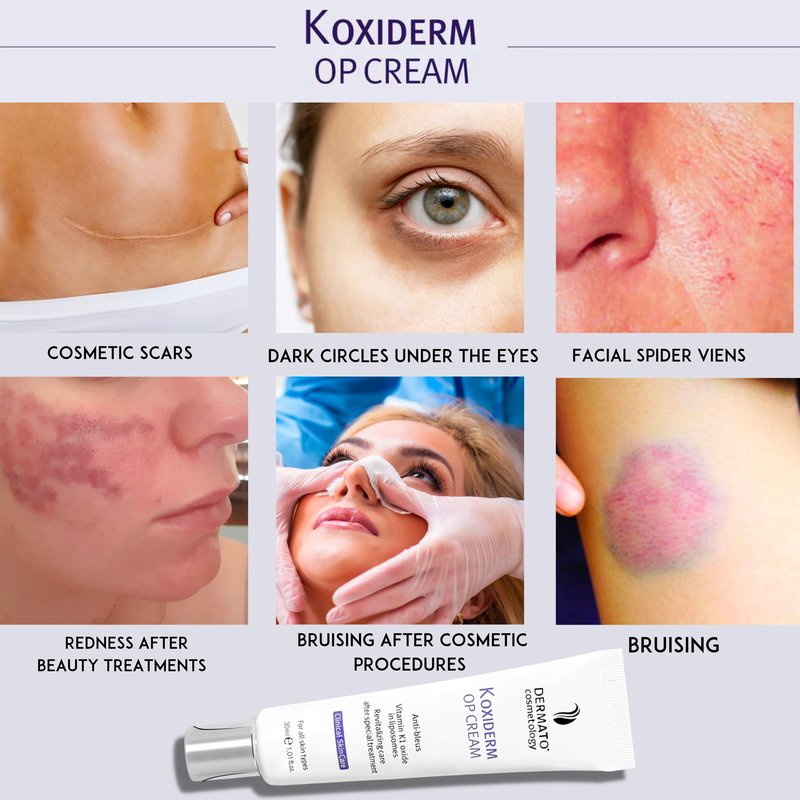 Anacis Vitamin K1 Oxiderm Cream Minimizing Appearance of Old and New Scars, Dark Eye Circles, Bruises, Varicose Veins, Redness Relieve 1.01Oz