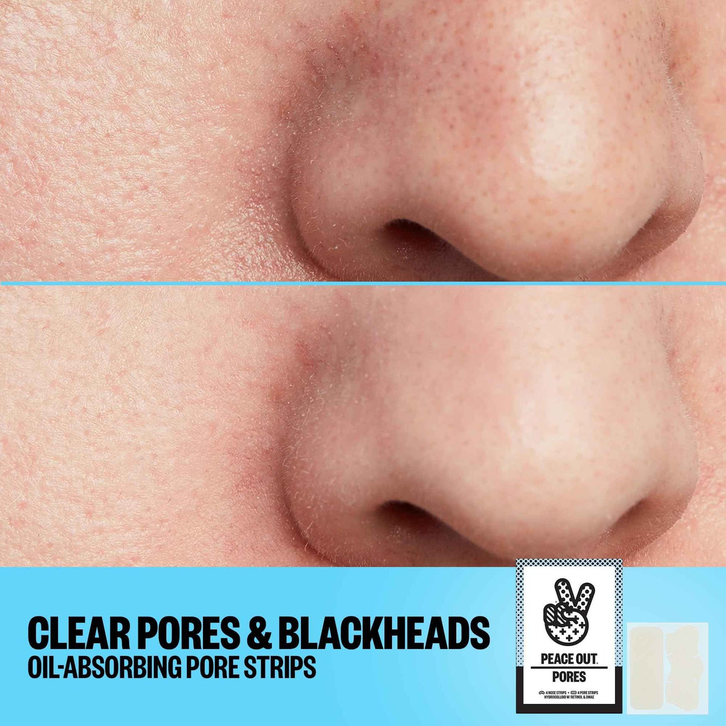 PEACE OUT Skincare Pore Minimizing Strips, Hydrocolloid Pore-Refining Nose and Face Strips with Retinol & Vitamin A to Shrink Enlarged Pores and Remove Blackheads (4 pore and 4 nose strips)