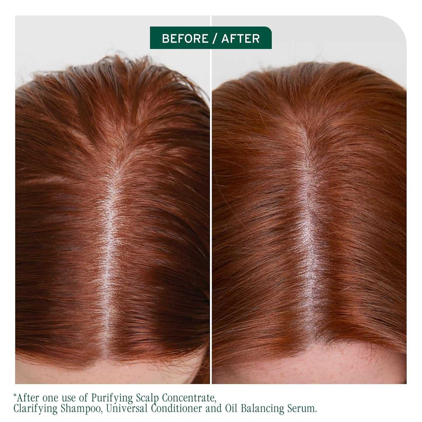 Biolage Scalp Sync Clarifying Shampoo - Oily Scalp Residue Remover | 13.5 Fl Oz