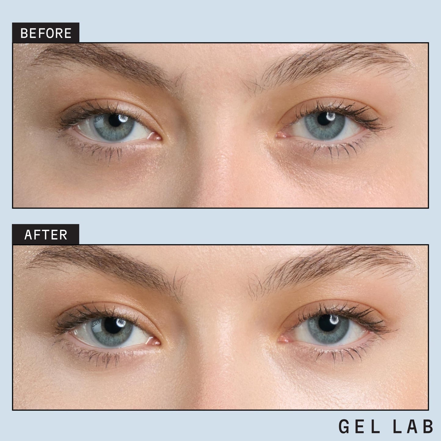 Gel Lab REGLOW Hyaluronic Acid & Caffeine Korean Skincare Eye Patches for Puffy Eyes, Dark Circles, and Wrinkles - Hydrating Under Eye Mask - 60 Gel Patches