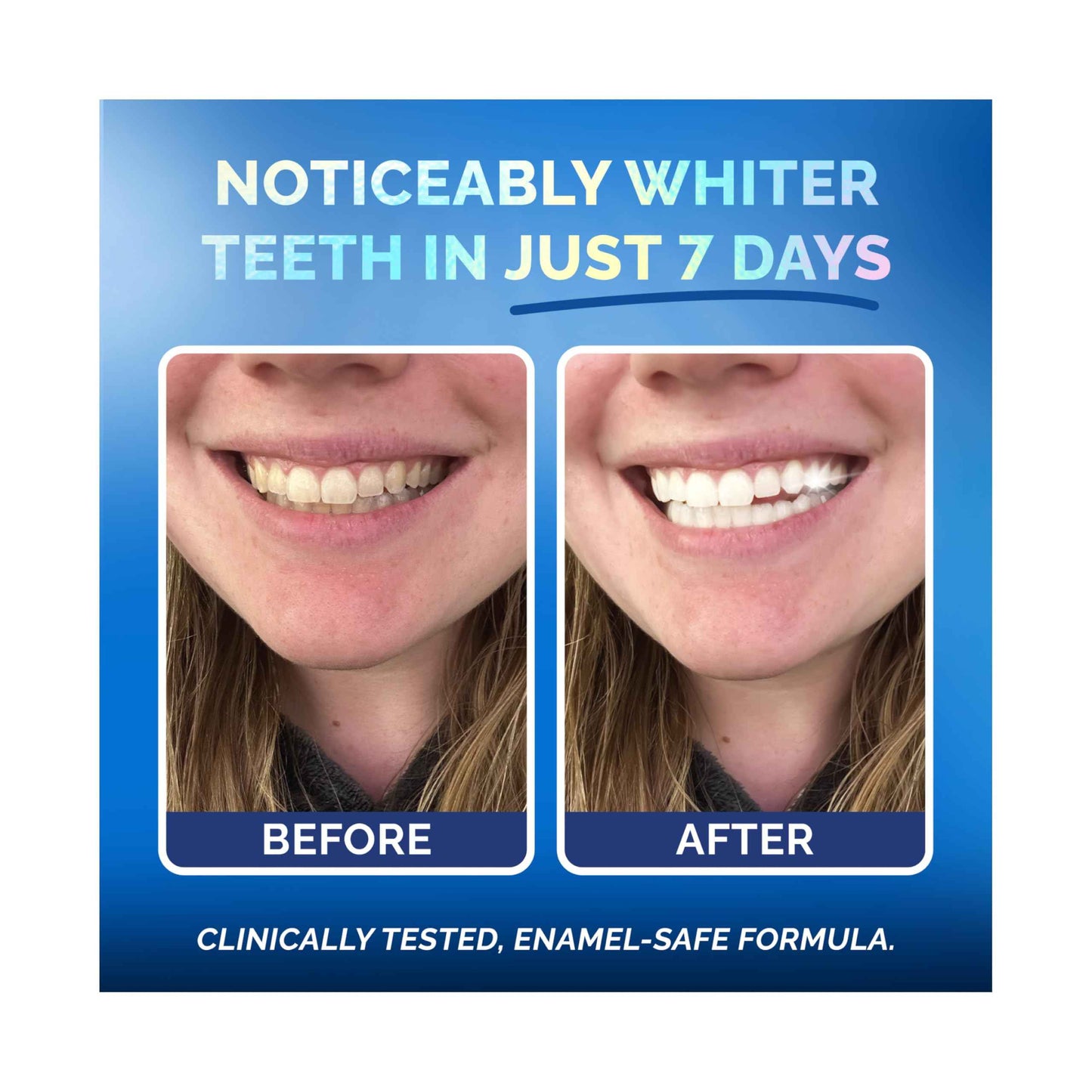 Whitening Strips for Sensitive Teeth 7 Treatments, Coconut – Enamel Safe, Peroxide-Free Coconut Teeth Whitening Strips with Natural Enzymes – Gentle White Stips for Sensitive Gums & Daily Oral Care