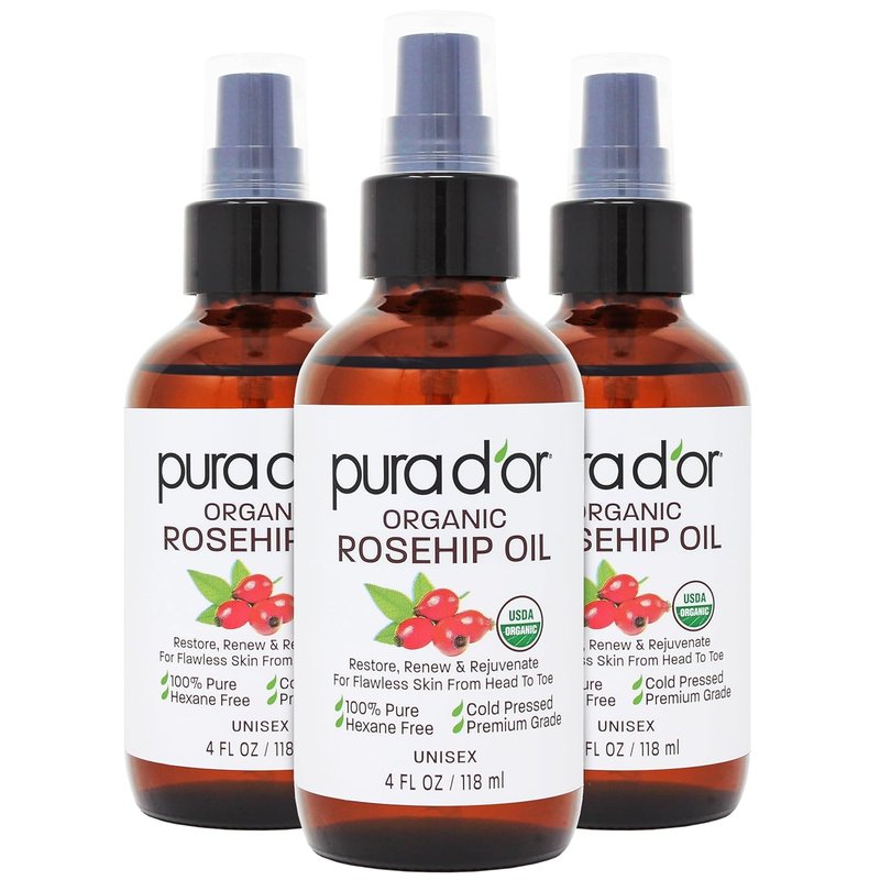 Organic Rosehip Seed Oil Hair Relaxer - 100% Pure Cold Pressed | Anti-Aging & Scar Treatment, 12 Oz