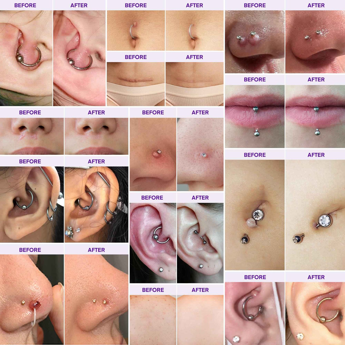 Piercing & Keloid Bump Solution Oil & Gel Kit, Piercing Aftercare Treatment Piercing Bump Solution Aftercare Oil (30 mL) + Keloid Bump Removal Gel (20 g) (2 Pack)