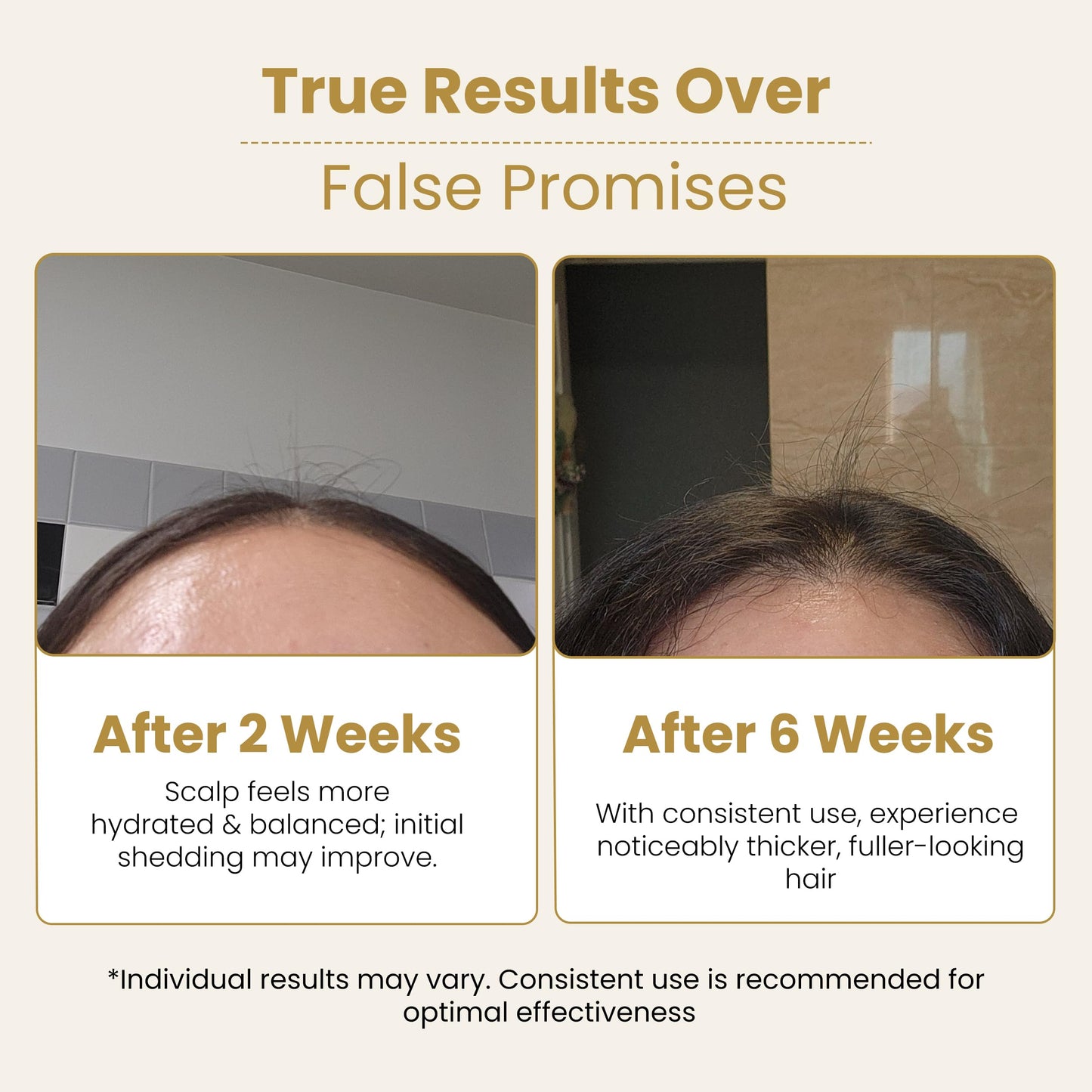 Mayam Beauty Minoxidil 5% Hair Regrowth Treatment Spray – Hair Growth Spray for Thinning Hair & Receding Hairline – Lightweight Leave-In Scalp Treatment with Bergamota – 125ml (4.2 fl oz)