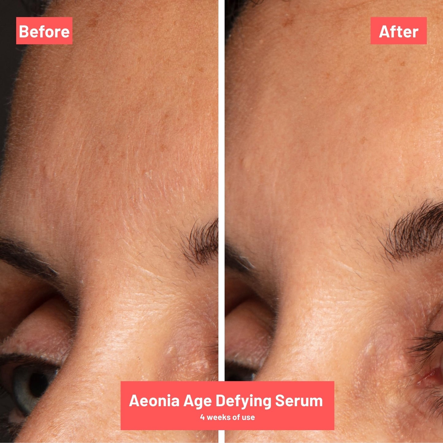 Aeonia Age-Defying Serum – Certified Space Technology Skincare, Age-Defying Face Serum with Bacillus Lysate, Resveratrol – Hydrates, Firms, Smooths Skin Texture & Reduces Fine Lines, 1 Fl Oz