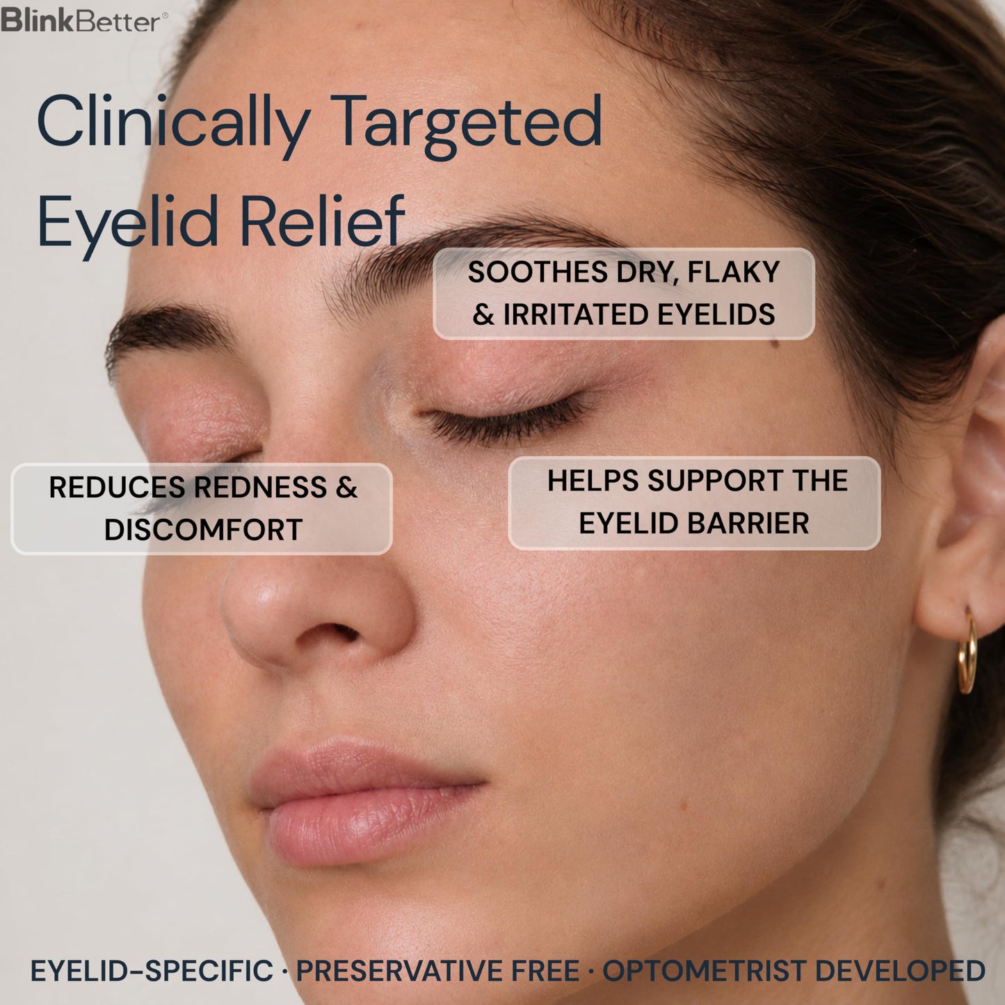 BlinkBetter BetterLids Restore Eyelid Cream – Barrier Support to Hydrate, Soothe & Moisturise Dry, Itchy, Red & Sensitive Eyelids – Lightweight Daily Formula with 3% Oat & Ceramides, 1 fl oz