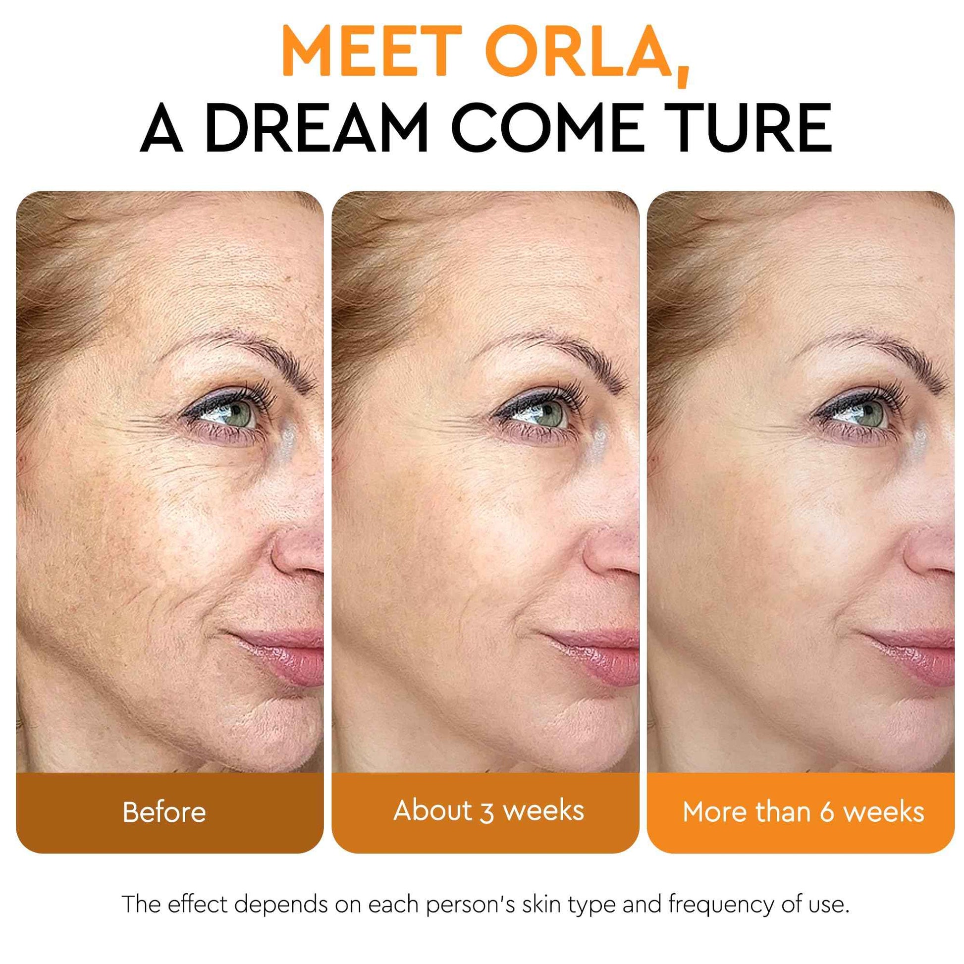 Super Vitamin C Serum For Women Over 70,Vitamin C Face Serum For Women Anti Aging Dark Spot Remover For Face Skin Care, Targets Age Spots, Wrinkles, Brightening, Pore Minimizer, Hydration 1.7fl Oz