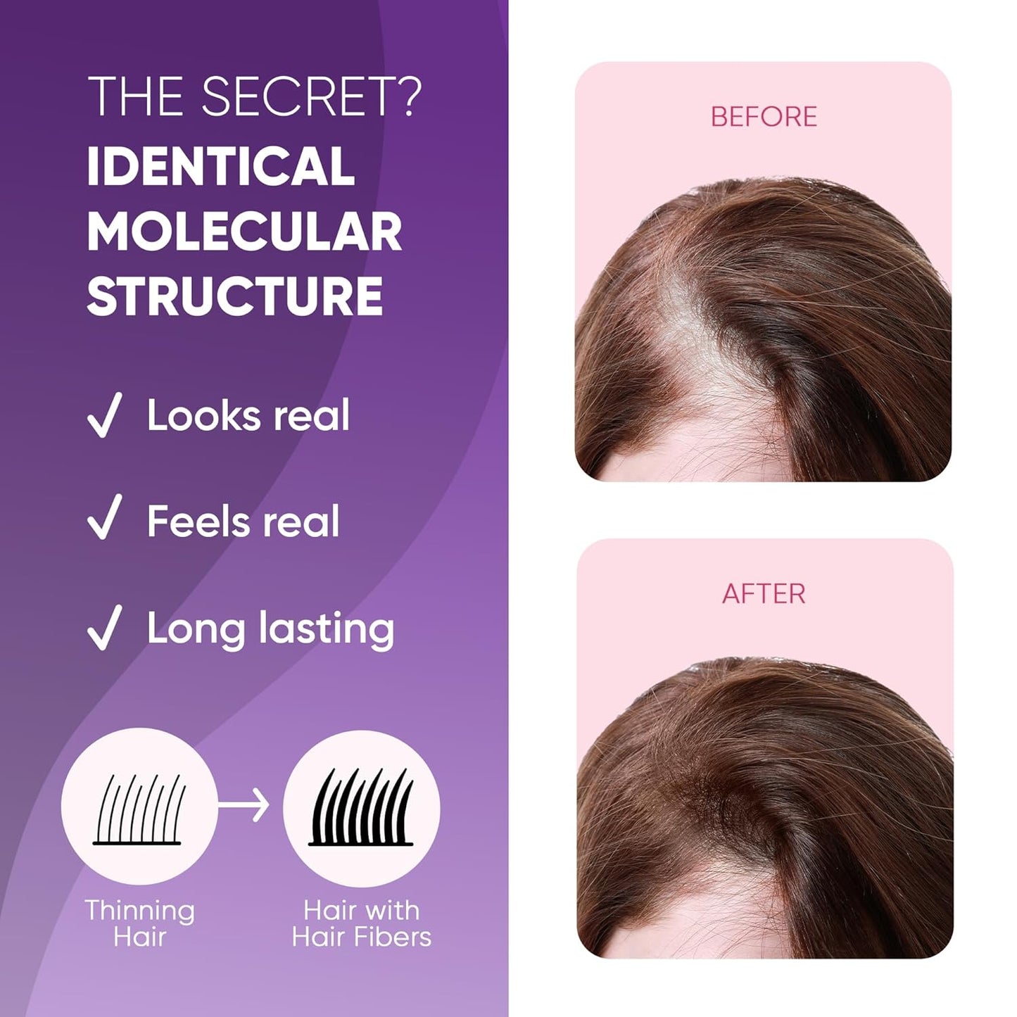 Hair Fibers for Thinning Hair & Bald Spots - Instant Cover Up & Volume | 25g White Powder for Men & Women