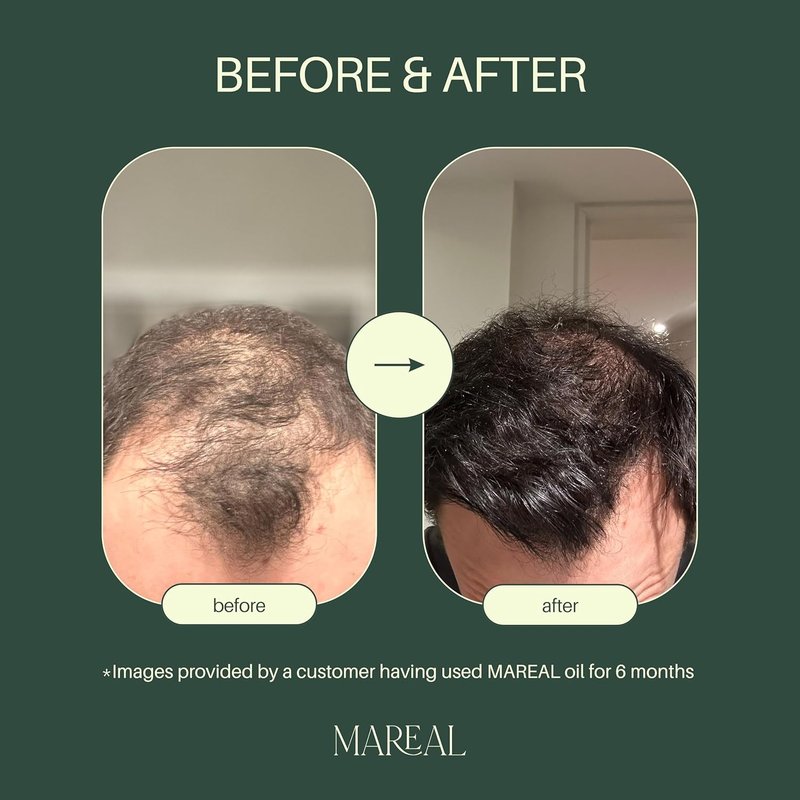 Pure Rosemary Oil for Hair Growth - Natural Hair Thickening & Regrowth Treatment | Infused with Castor & Coconut Oil | 1.7 fl oz