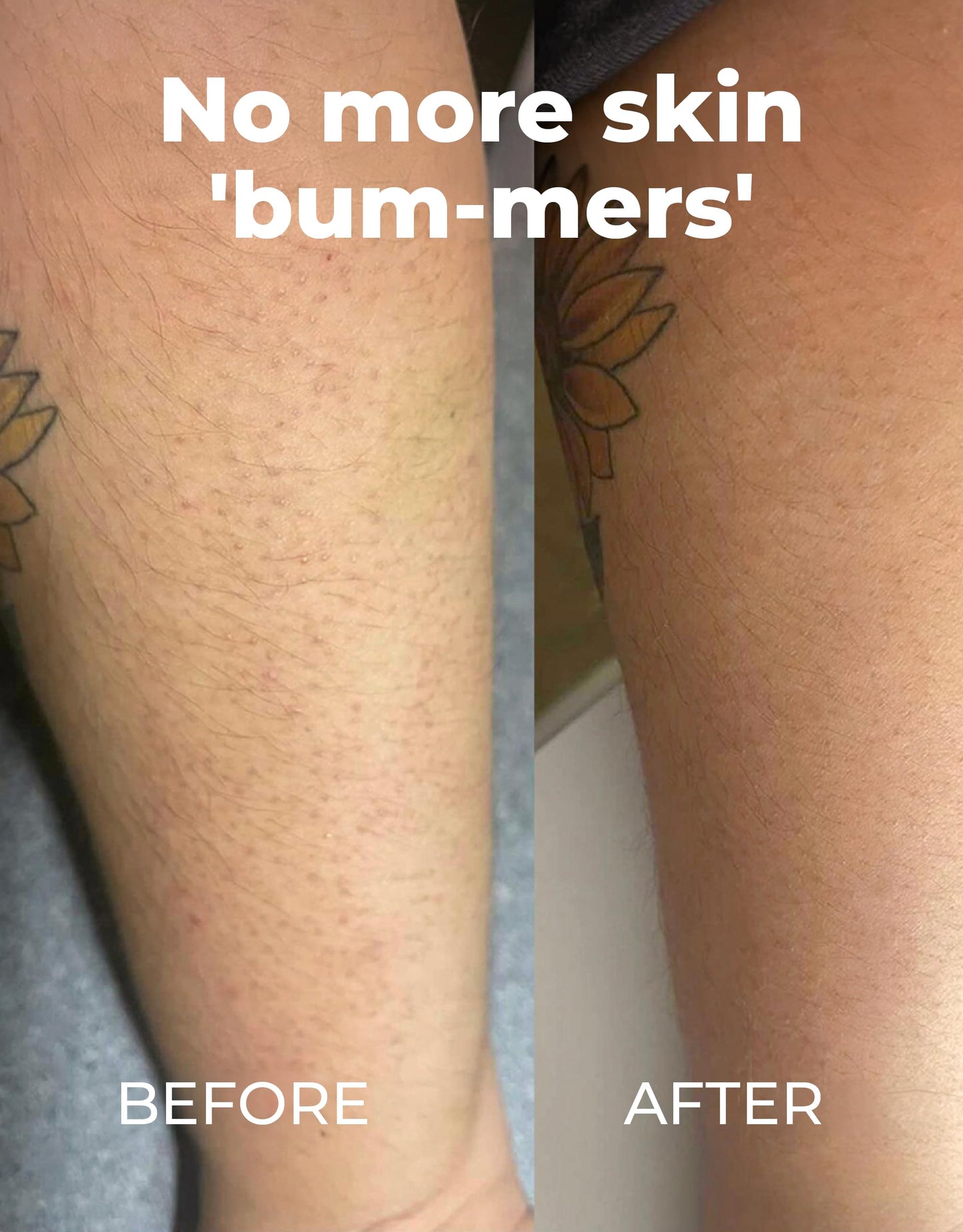 Miami Beach Bum Bum Body Cream - 3.4 oz Bum Lotion Oregano Aloe + Jojoba Daily Moisturizer for Skin Health, Razor Bumps, Keratosis Pilaris, Ingrown Hairs, Sunburns, Blemishes