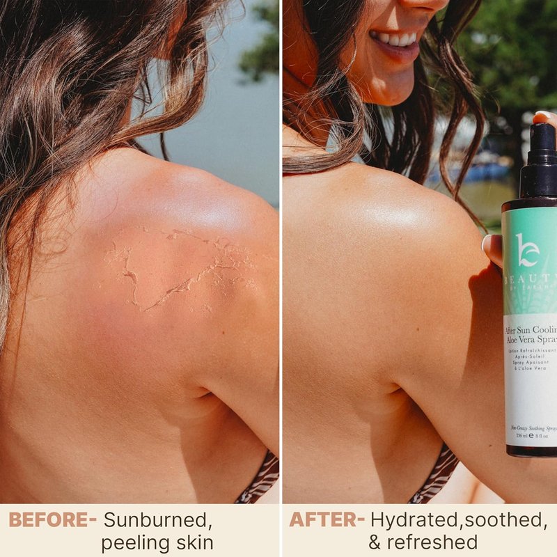 Aloe Vera After Sun Cooling Spray - Organic Formula for Sunburn Relief & Skin Hydration | Fast Absorbing, USA Made