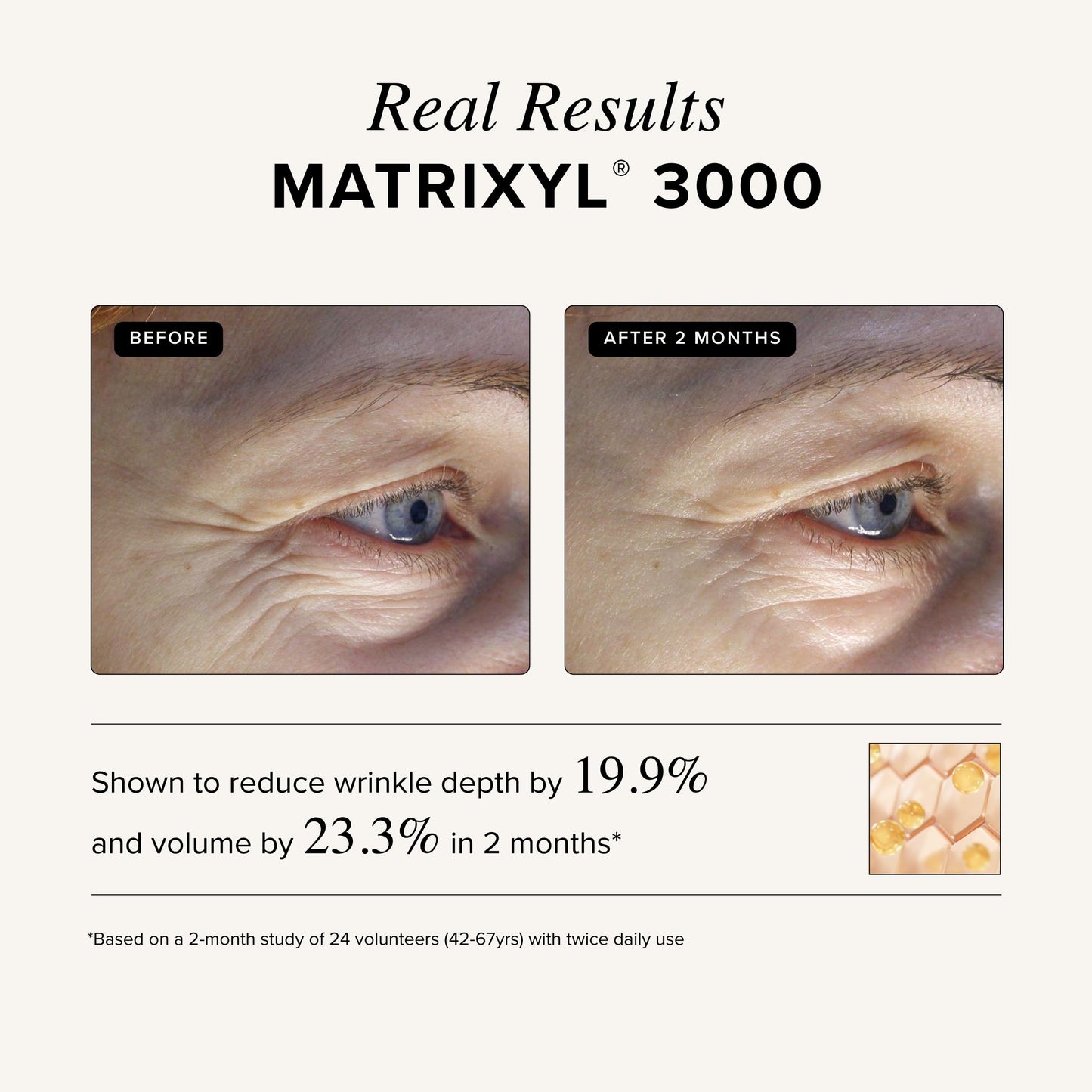 Asterwood Matrixyl 3000 + Argireline Serum for Face - Multi Peptide Serum with Hyaluronic Acid - Anti-Aging, Wrinkle Reducing, Collagen Boosting - Fragrance-Free - 8 Fl Oz