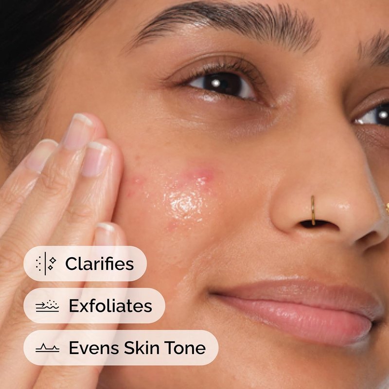 The Ordinary Salicylic Acid 2% Exfoliating Serum - Blemish Control for Uneven Skin Texture