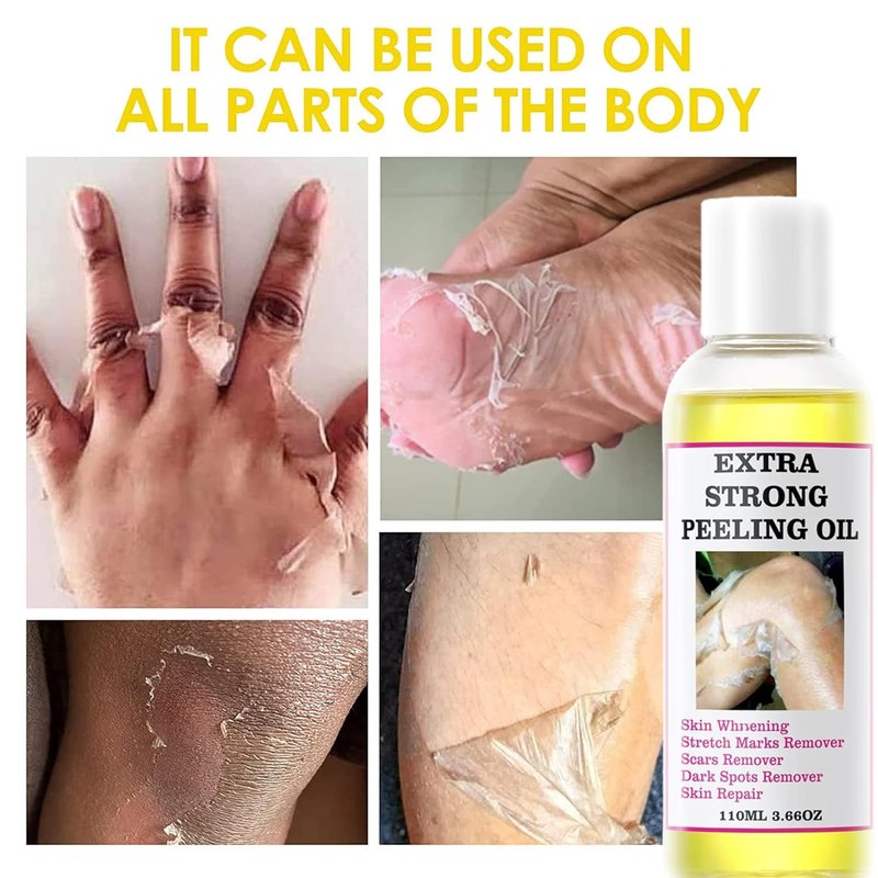 Yellow Peeling Oil - Exfoliating Body Oil for Dark Skin | 330ML/10.98Fl Oz
