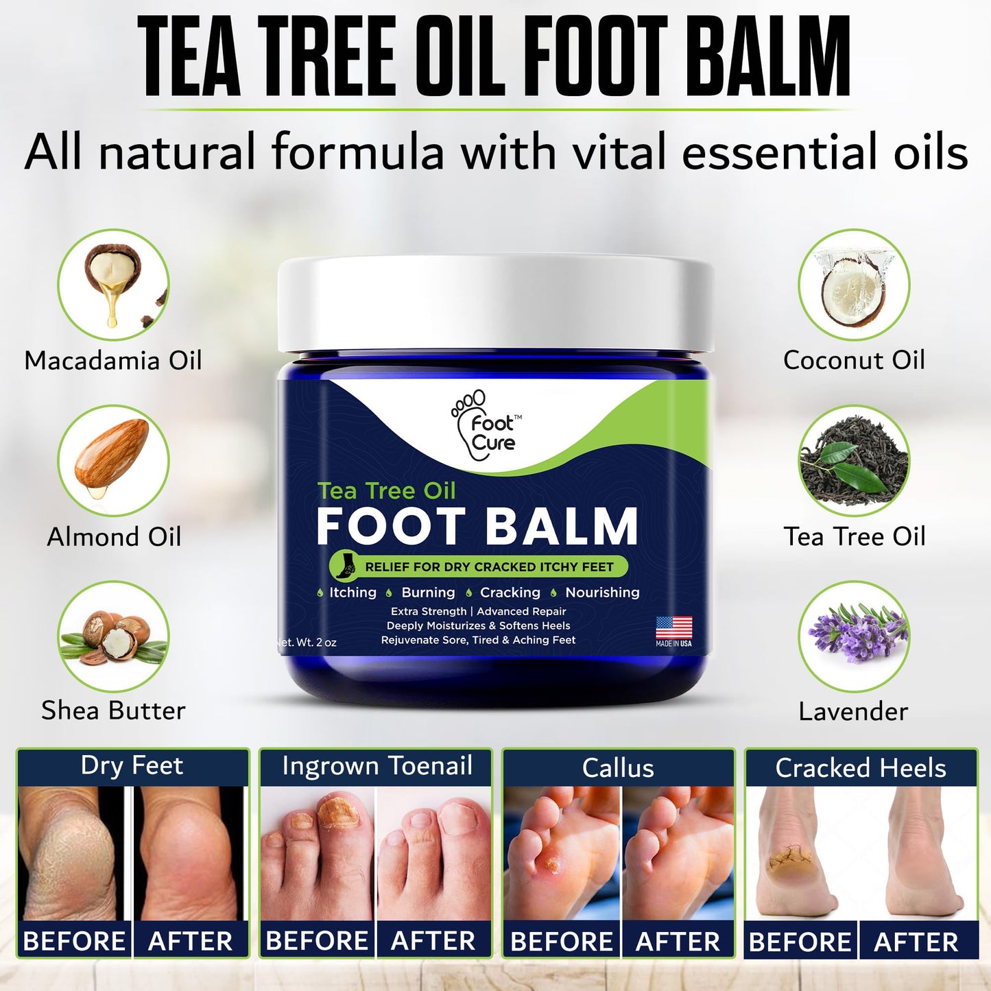 FOOT CURE Tea Tree Oil Balm – Moisturizer for Dry Cracked Feet – Instantly Hydrates & Soothes Irritated Skin & Athlete's Foot – Best Foot Care for Women and Men (Pack of 2)