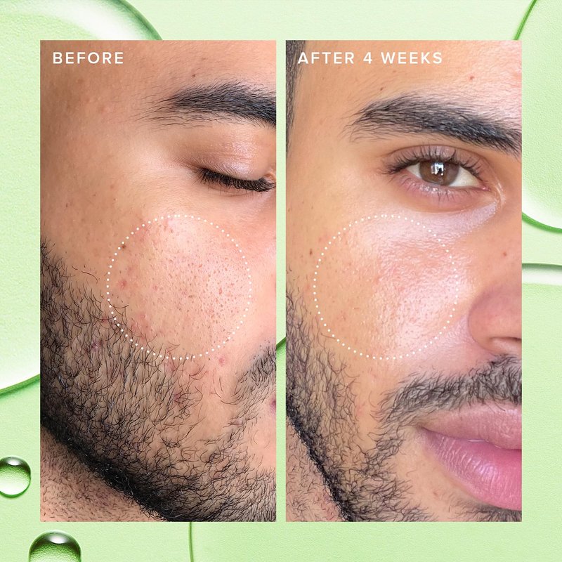 Farmacy 2% Salicylic Acid Toner for Face - Deep Sweep BHA Liquid Exfoliant + Pore Cleaner - Controls Oil, Gently Exfoliates + Refines Pores - Skin Care for Combo, Oily + Blemish-Prone Skin - (120ml)