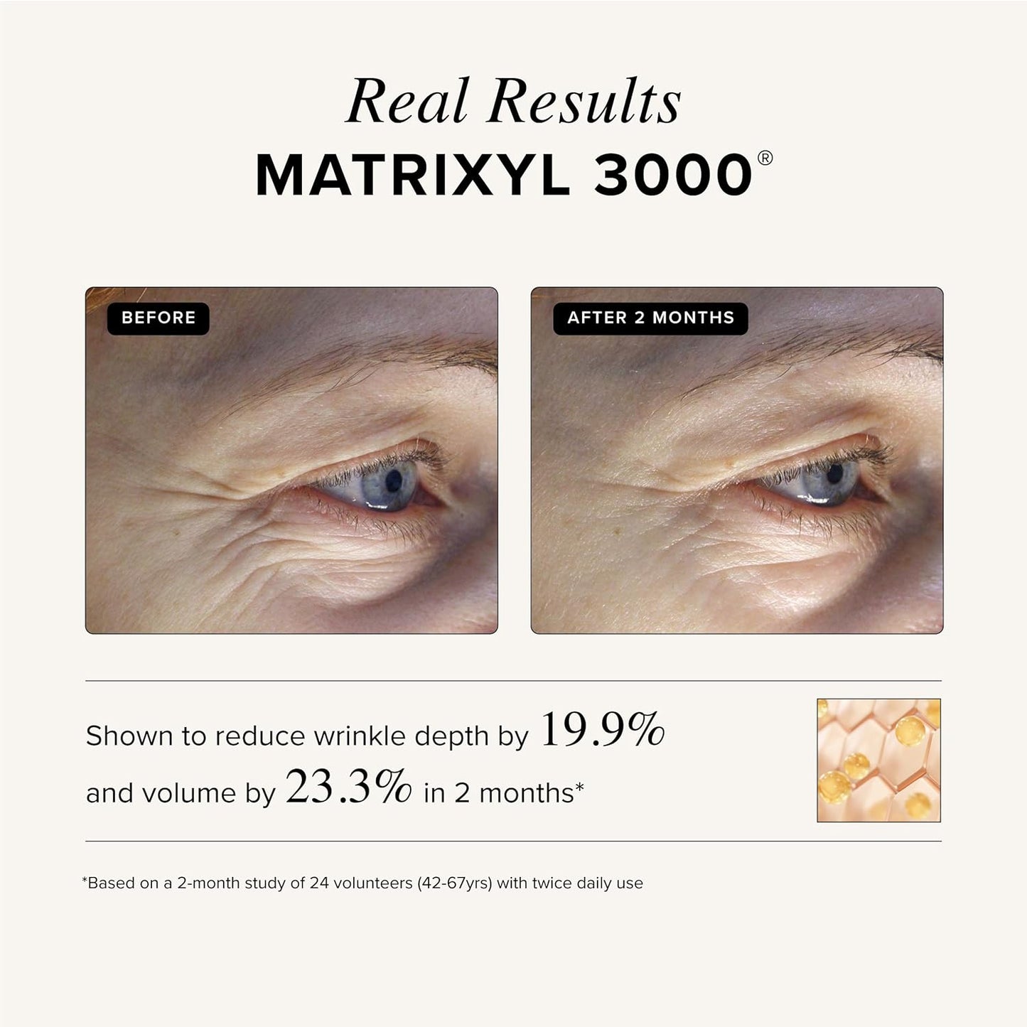 Asterwood Matrixyl 3000 Serum - Anti-Aging Hyaluronic Acid & Vitamin C for Hydration | 1 Fl Oz