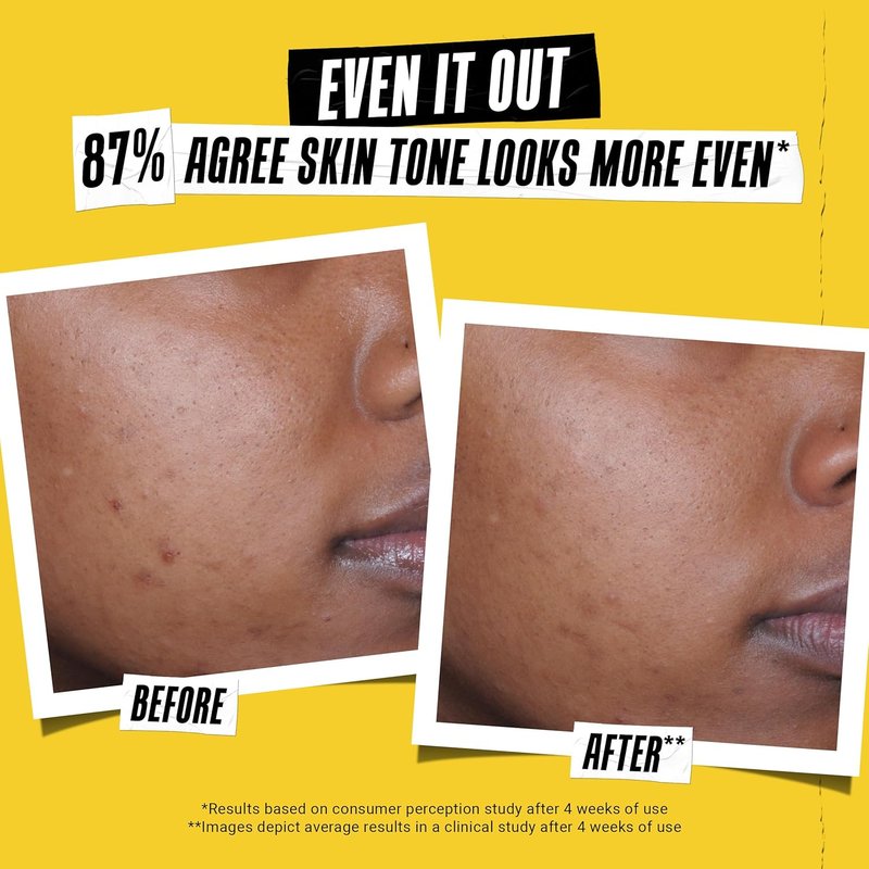 Kiehl's Better Screen UV Serum SPF 50+ | Invisible Facial Sunscreen with Collagen Peptide & UV Protection